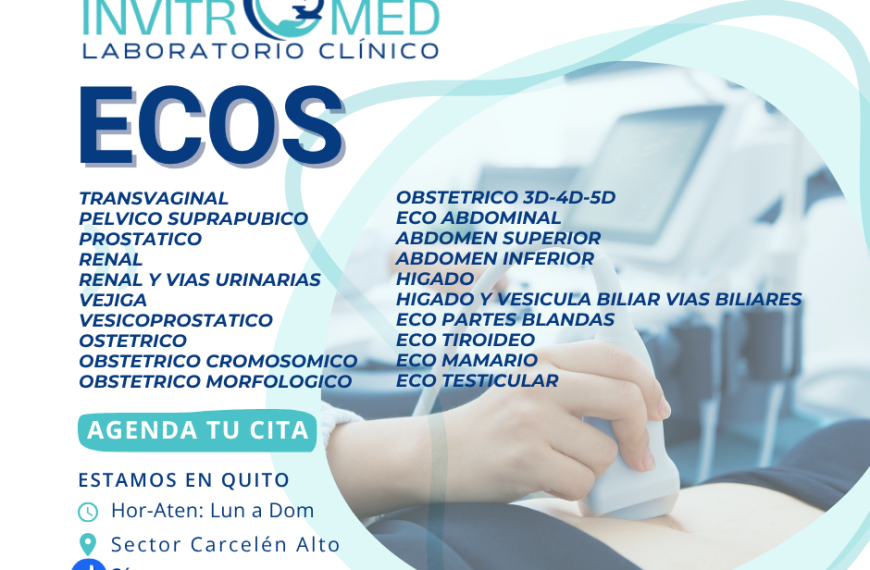 ECOS EQUIPO DE ALTA TECNOLOGIA